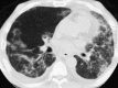 Fig. 18