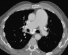 Fig. 13