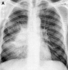 Fig. 20
