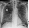 Fig. 10