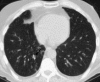 Fig. 12