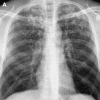 Fig. 22