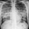 Fig. 15
