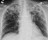 Fig. 21