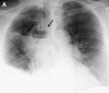 Fig. 9