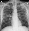 Fig. 19