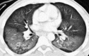 Fig. 16