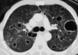 Fig. 17