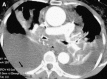 Fig. 29