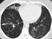 Fig. 25