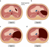Fig. 14