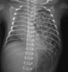 Fig. 13
