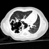 Fig. 12