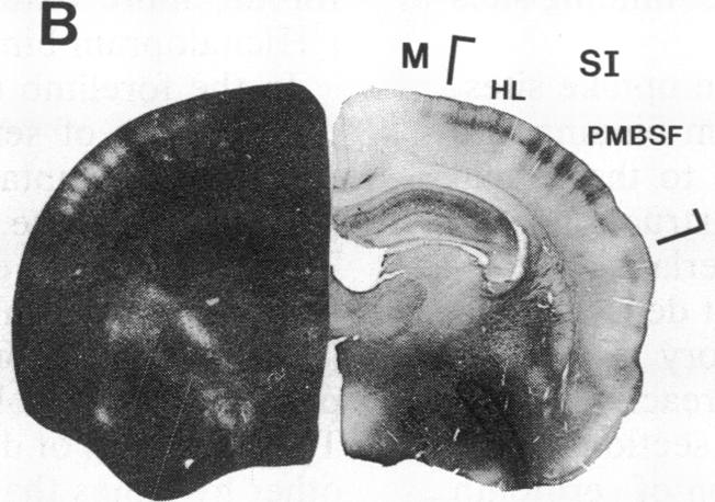 graphic file with name pnas00277-0381-b.jpg