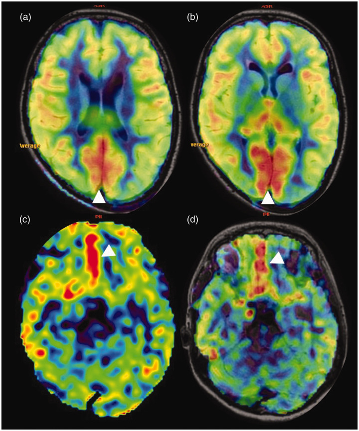 Figure 13.