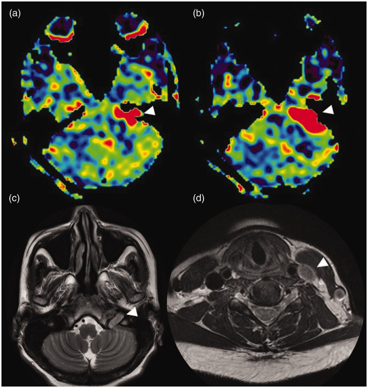 Figure 11.