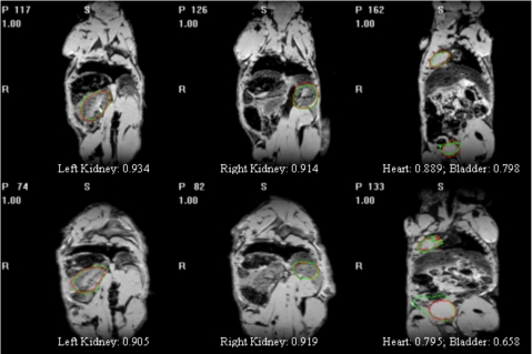 Figure 11