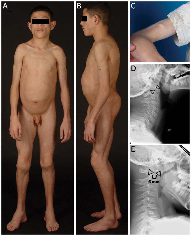 Fig. 1