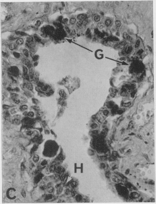 Fig. 1C