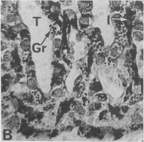 Fig. 2B