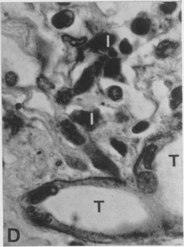 Fig. 1D