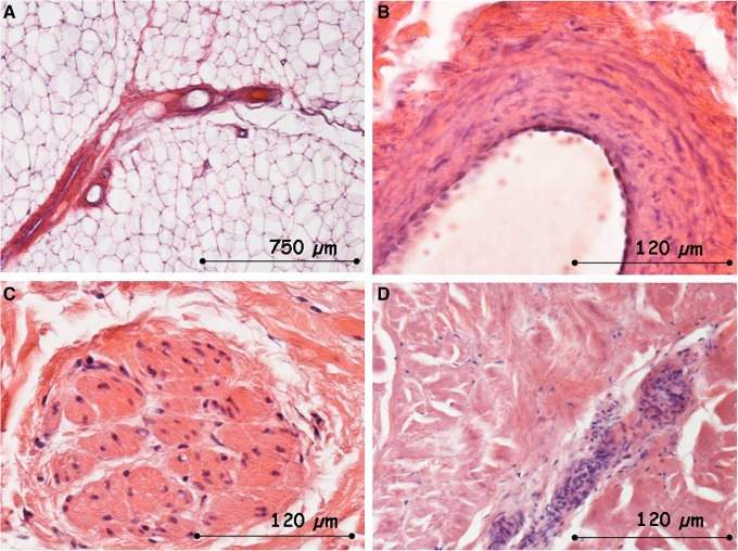 FIG. 18.