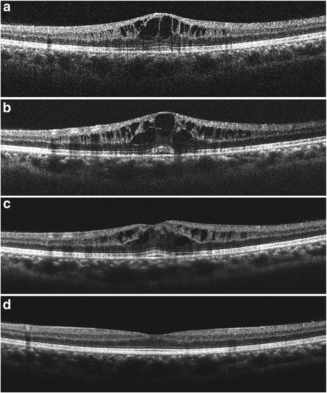 Fig. 3