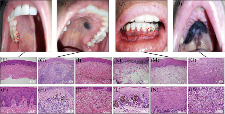 Figure 1