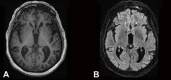The patient’s MRI does not show any significant abnormality