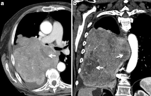 Fig. 11