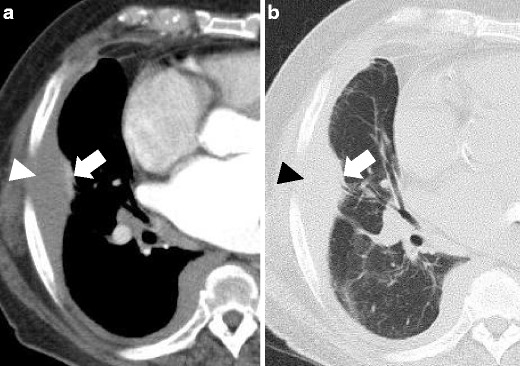 Fig. 12