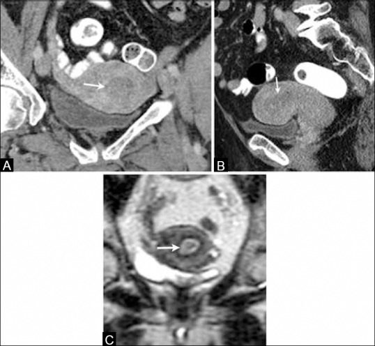 Figure 3 (A-C)