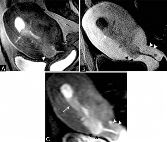 Figure 12 (A-C)