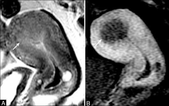 Figure 10 (A and B)