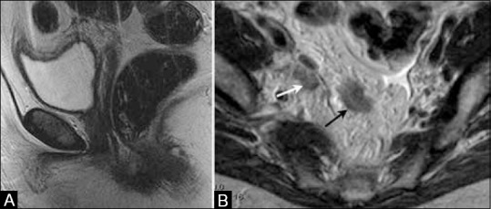 Figure 18 (A and B)