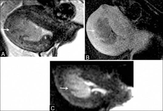 Figure 9 (A-C)