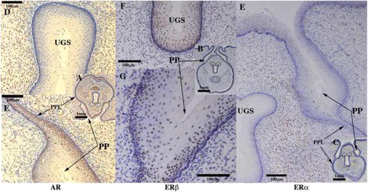 Figure 17