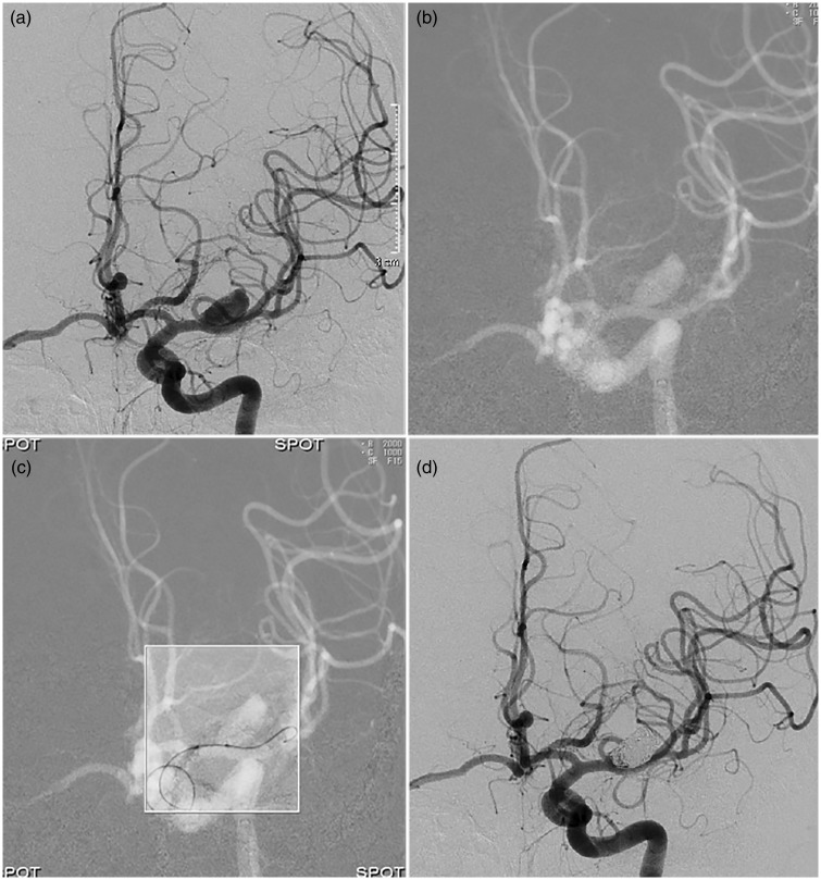 Fig. 2.