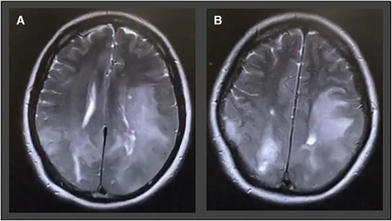 Fig 6