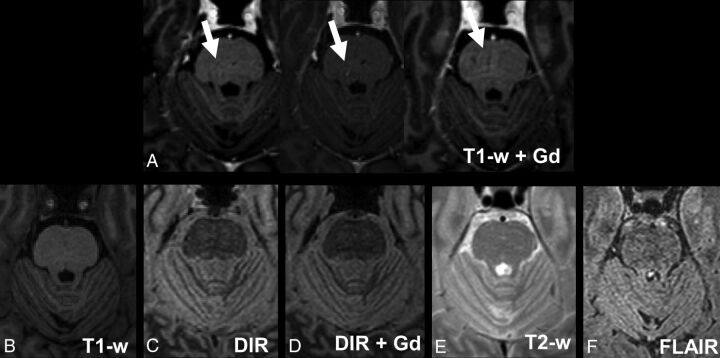 Fig 4.