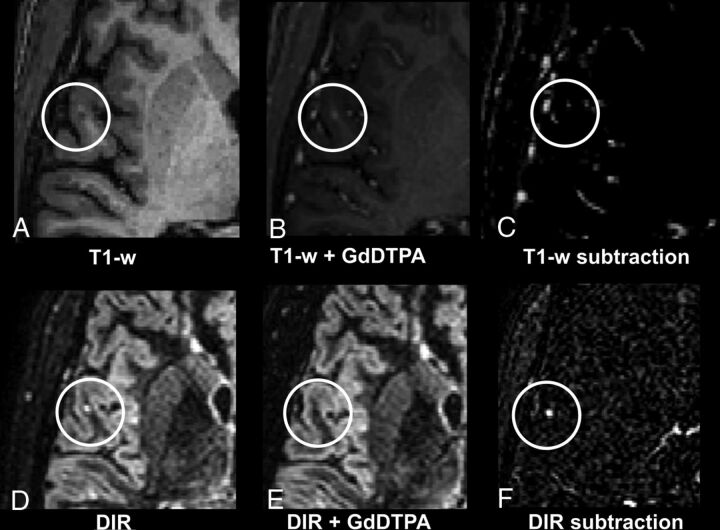 Fig 2.