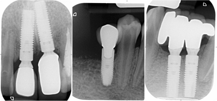 Fig. 13