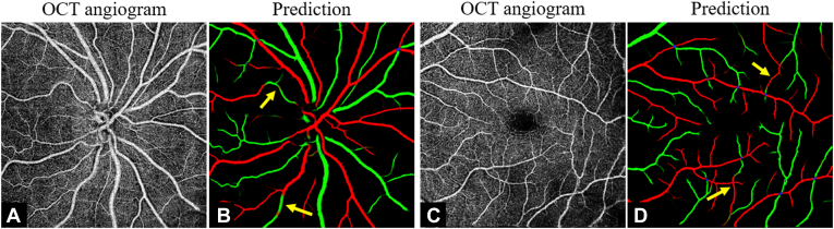 Figure 4