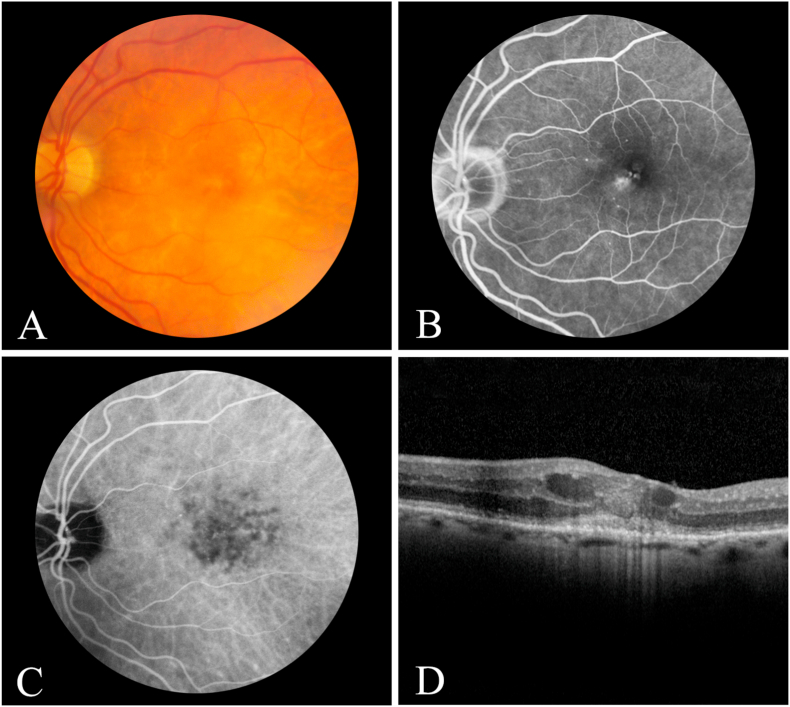 Fig. 1