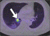 Fig. 10—