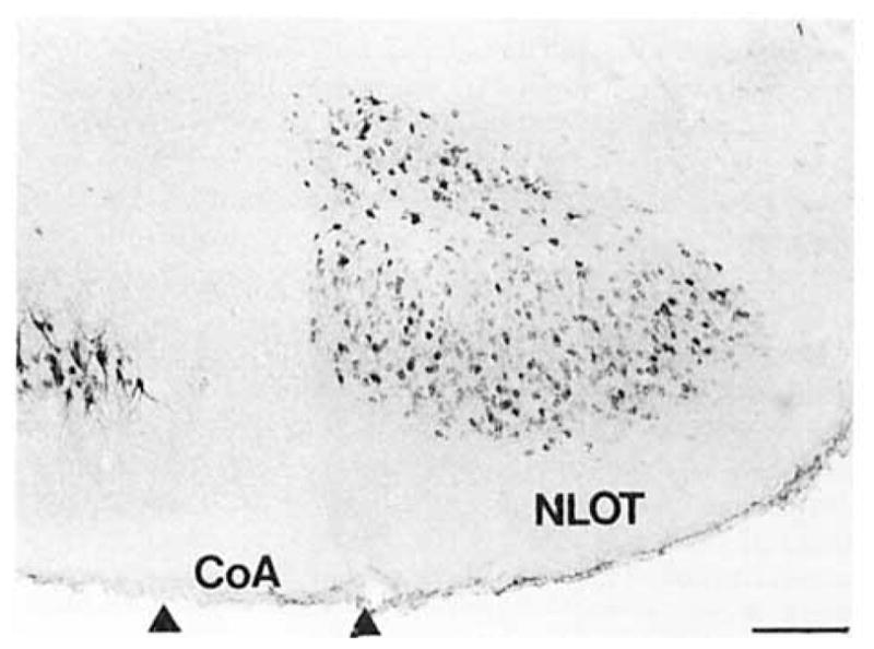 Fig. 12