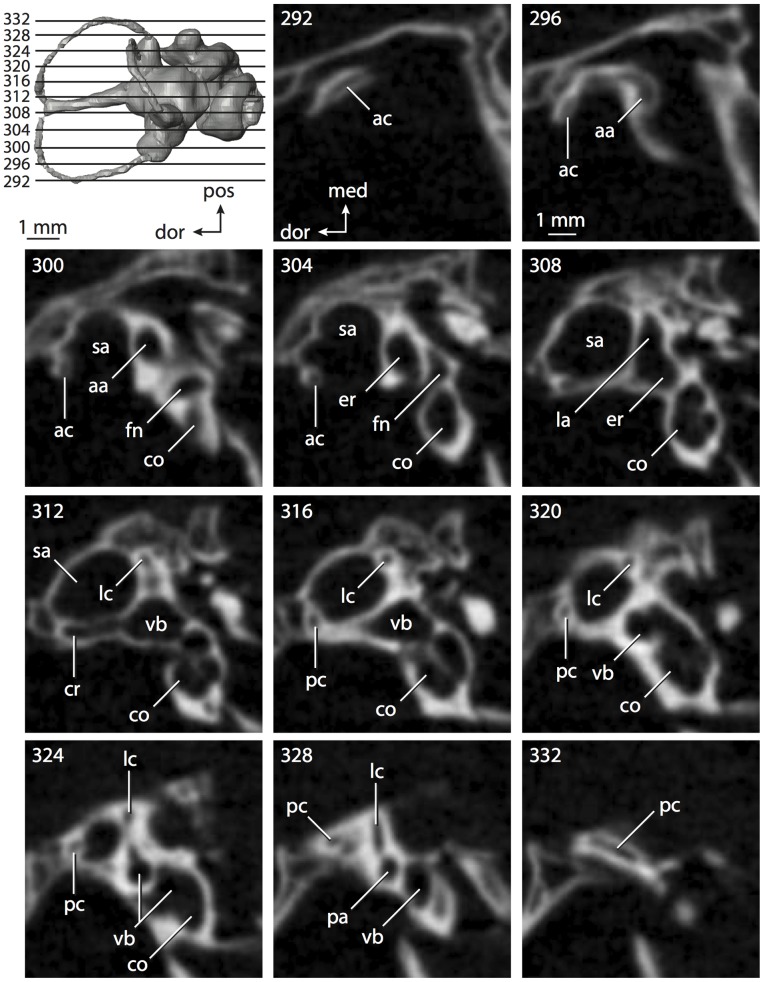 Figure 11