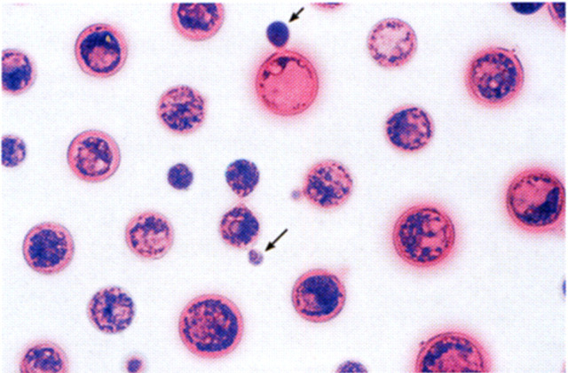 Fig 8.