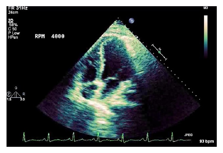 Figure 4