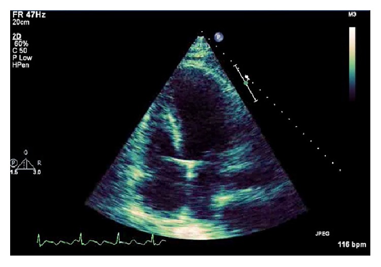 Figure 5